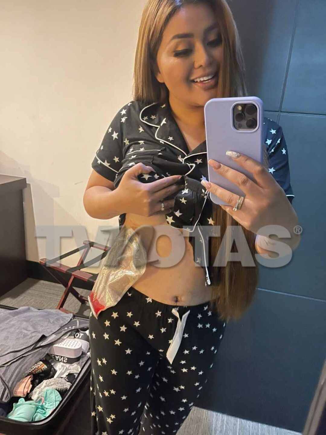 gomita_cirugias_bypass_60kilos_tvnotas