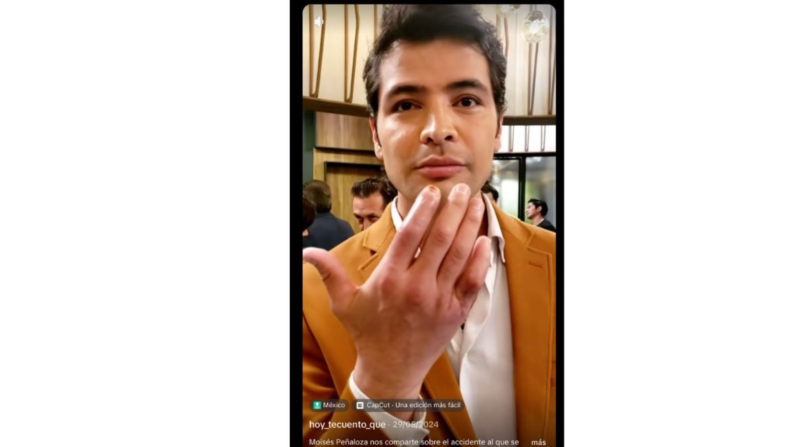Moisés Peñaloza dedos chuecos