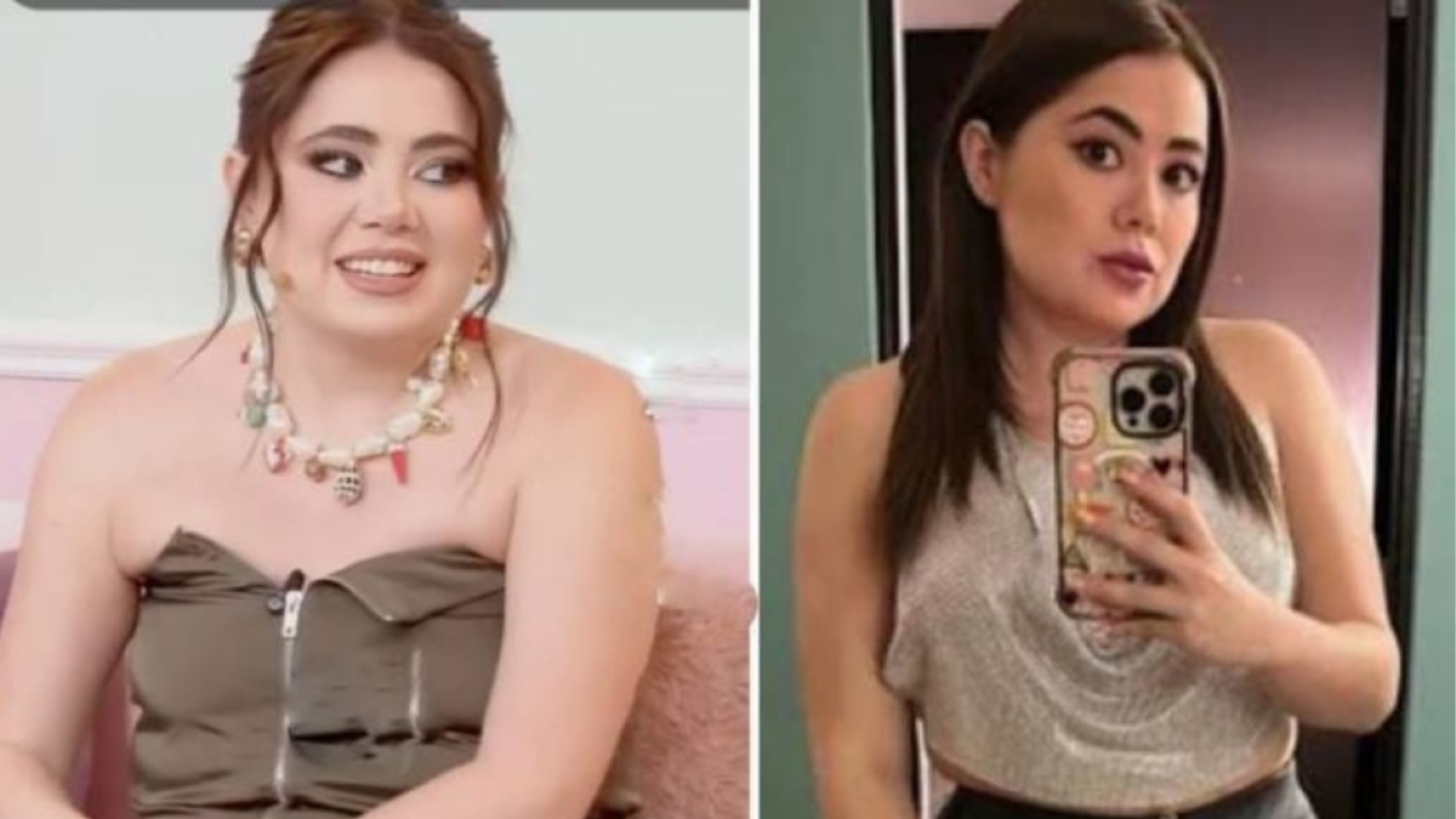 Mariana Botas antes y despues