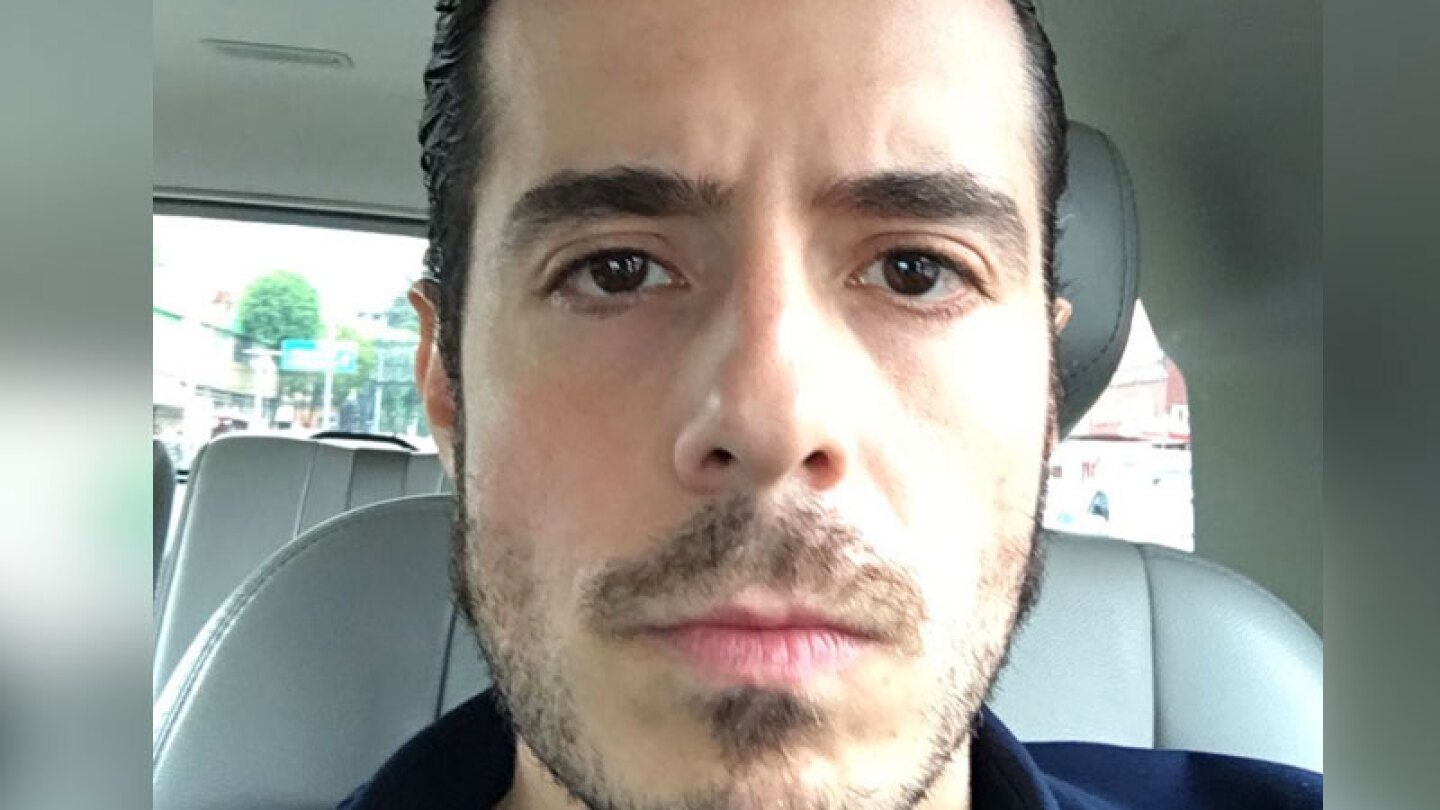 Ex vocalista de Panda resulta agredido en pleno concierto