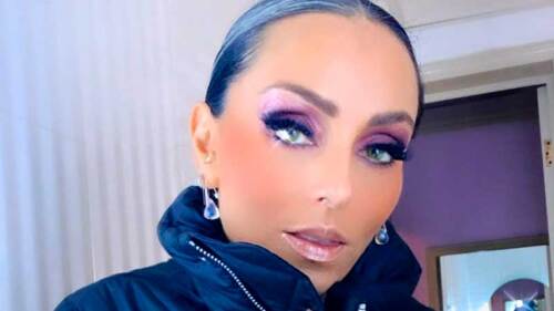 Ivonne Montero no dejará de usar pupilentes pese a haberse dañado la córnea