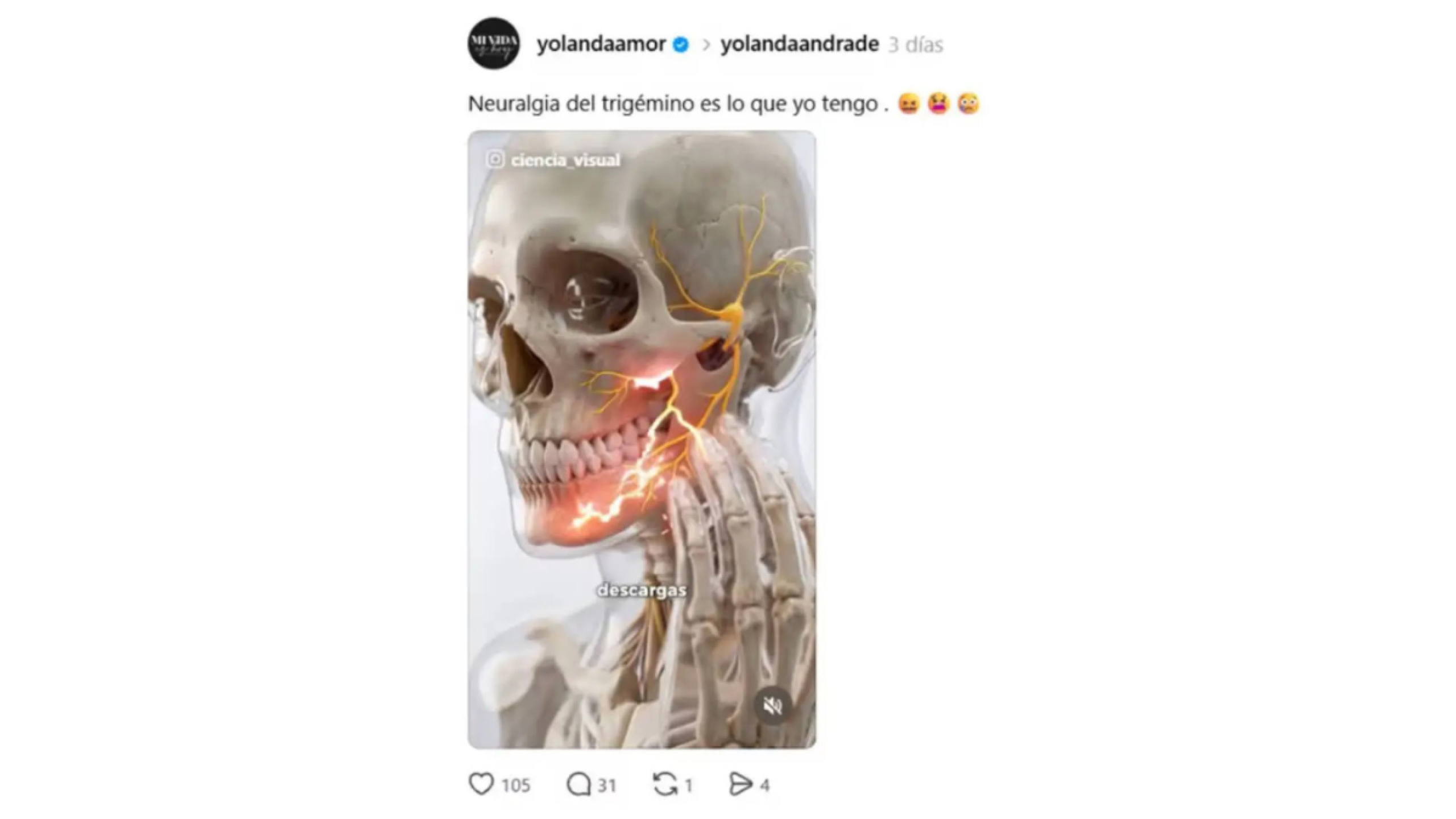 Yolanda Andrade padece neuralgia del trigémino