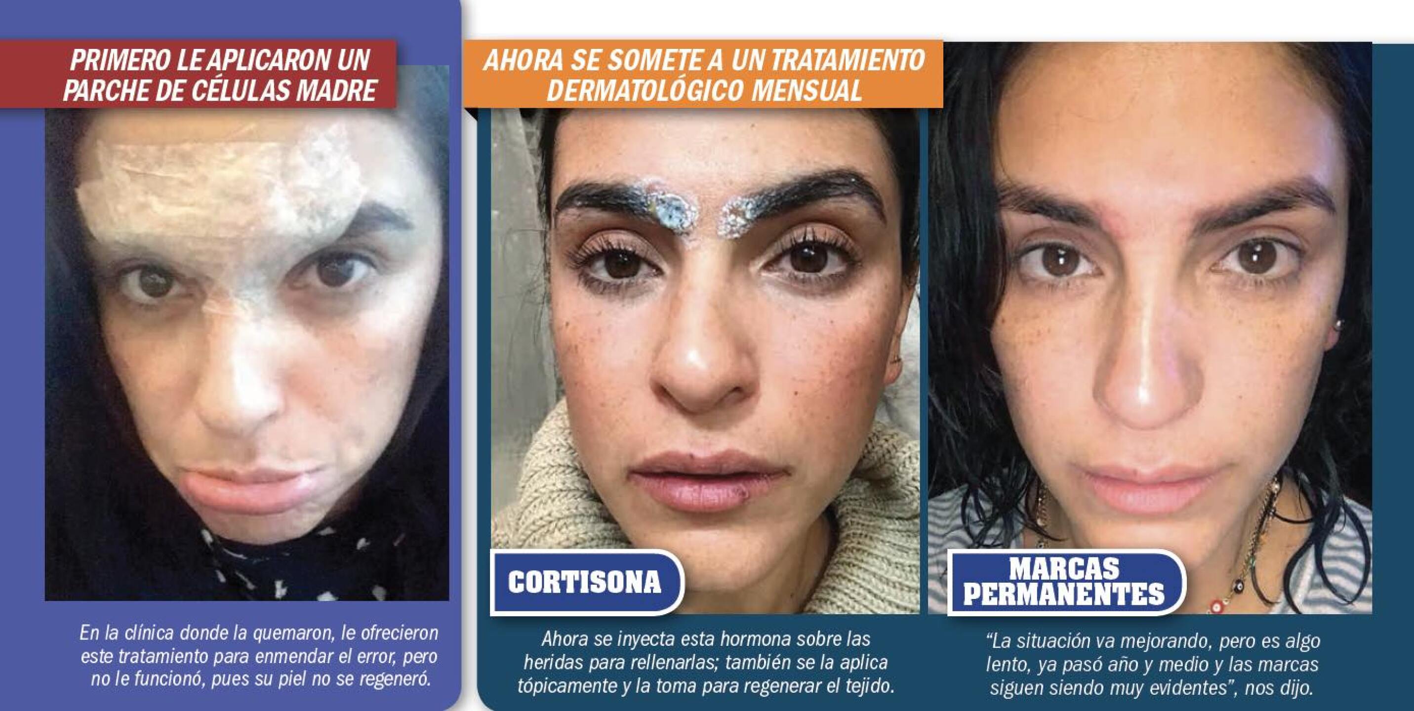 Liz quería lucir cejas a la moda.