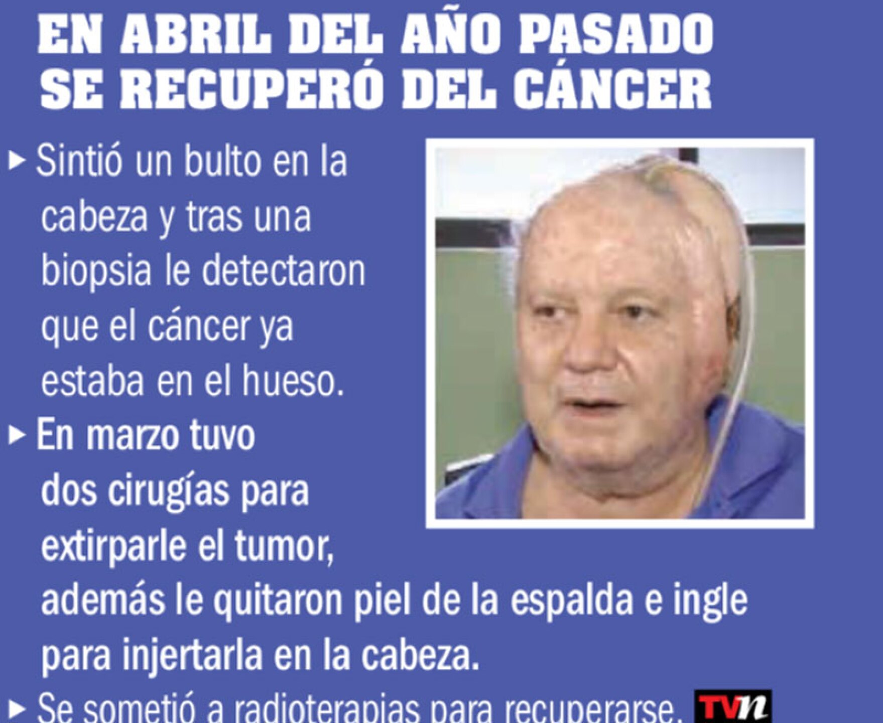 Sergio DeFassio se puso un injerto de cabello