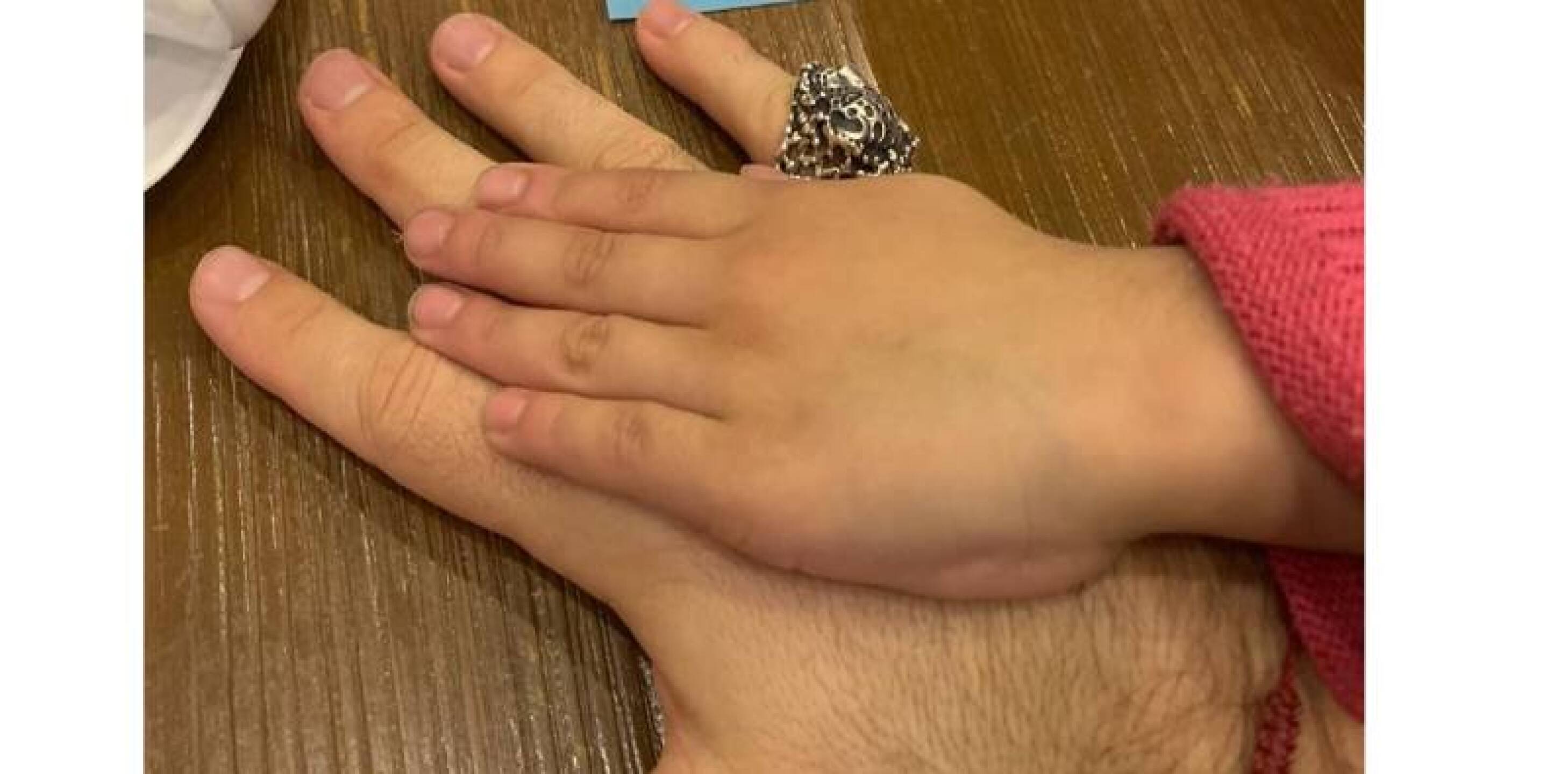 Adrián di Monte de luto