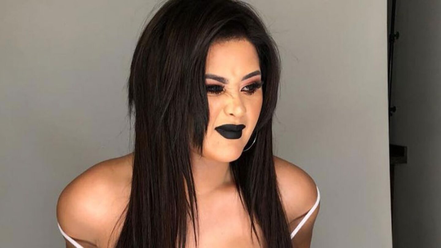 La ex payasita fue duramente criticada por hacer evidente su adicción a las cirugías plásticas