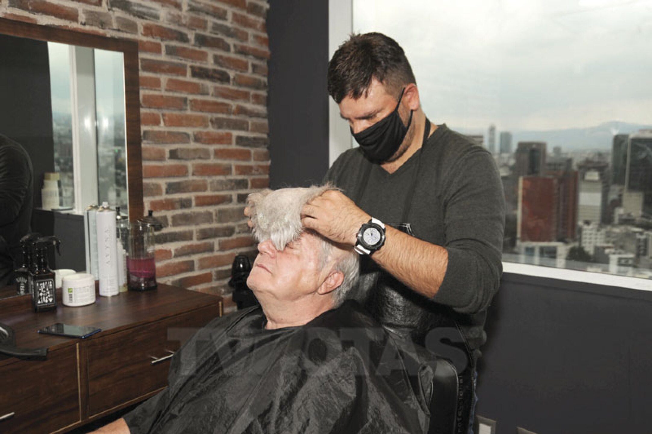 Sergio DeFassio se puso un injerto de cabello