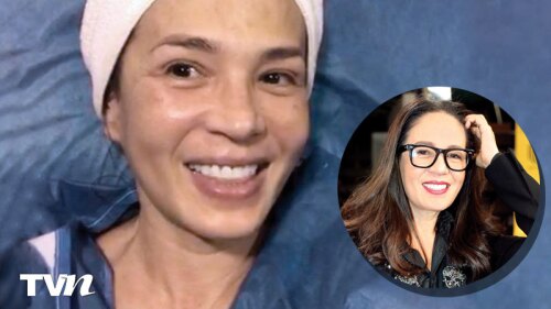 yolanda andrade cirugía rejuveneció