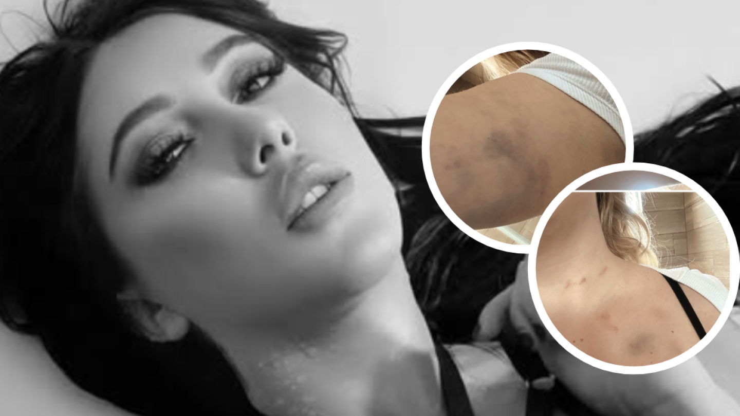 Isa Castro sufrió abuso por parte de dos hombres