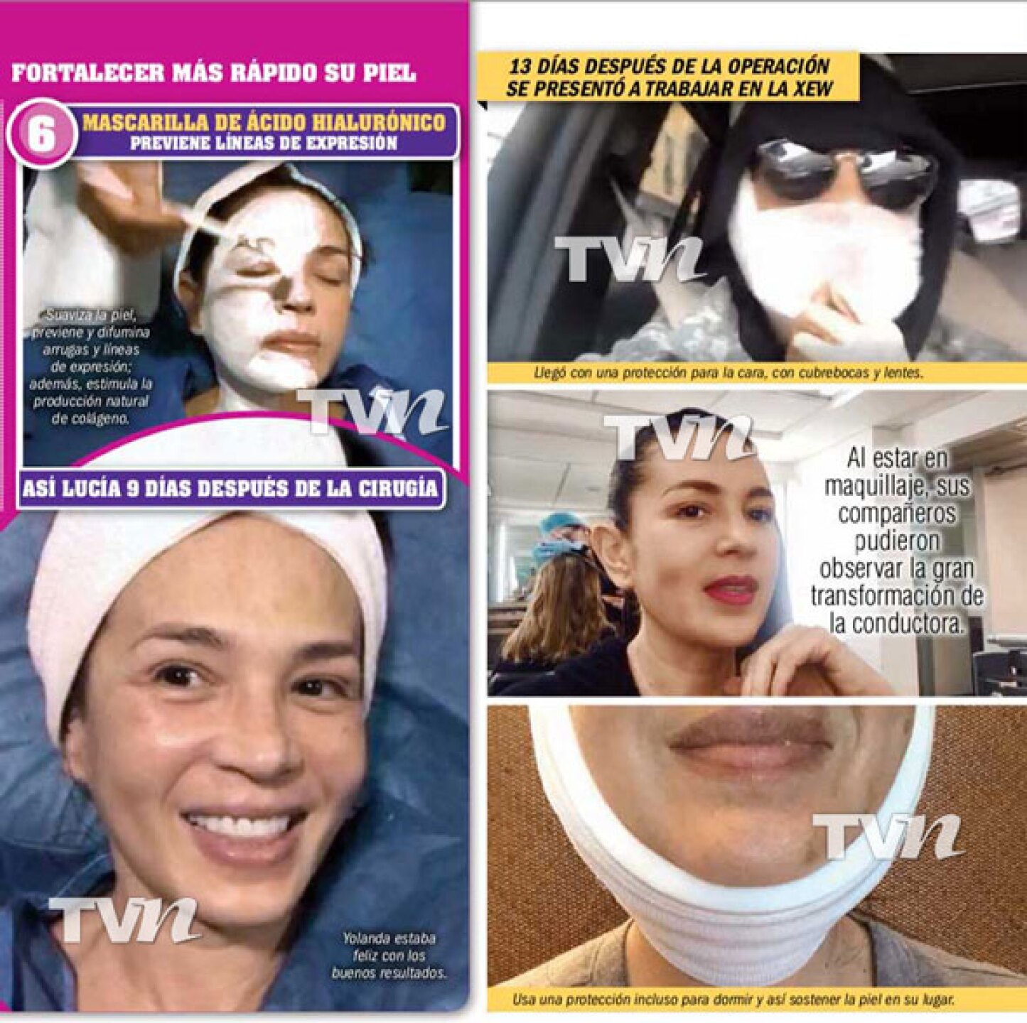yolanda andrade cirugía rejuveneció