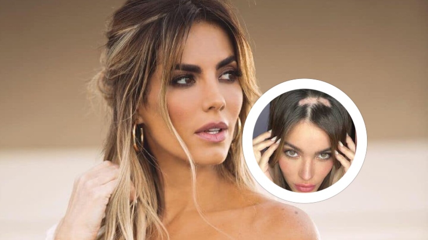 Gaby Espino lanza mensaje en contra de personas sin pelo