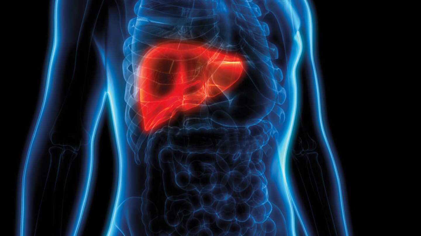 La cirrosis es una etapa tardía de la formación de cicatrices (fibrosis) en el hígado causada por diversas afecciones y enfermedades hepáticas.