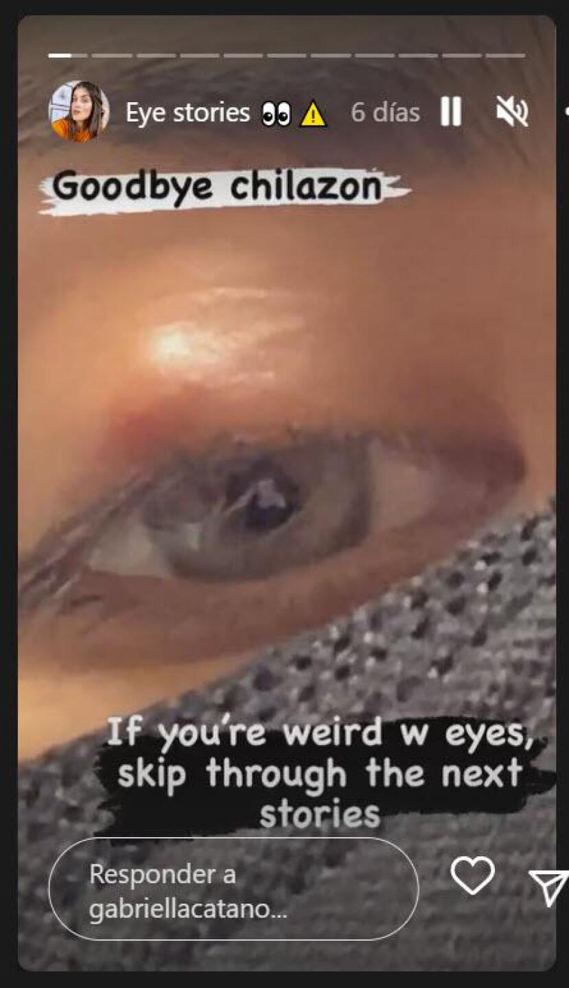 Hija mayor de Jorge Salinas se realiza cirugía en el rostro