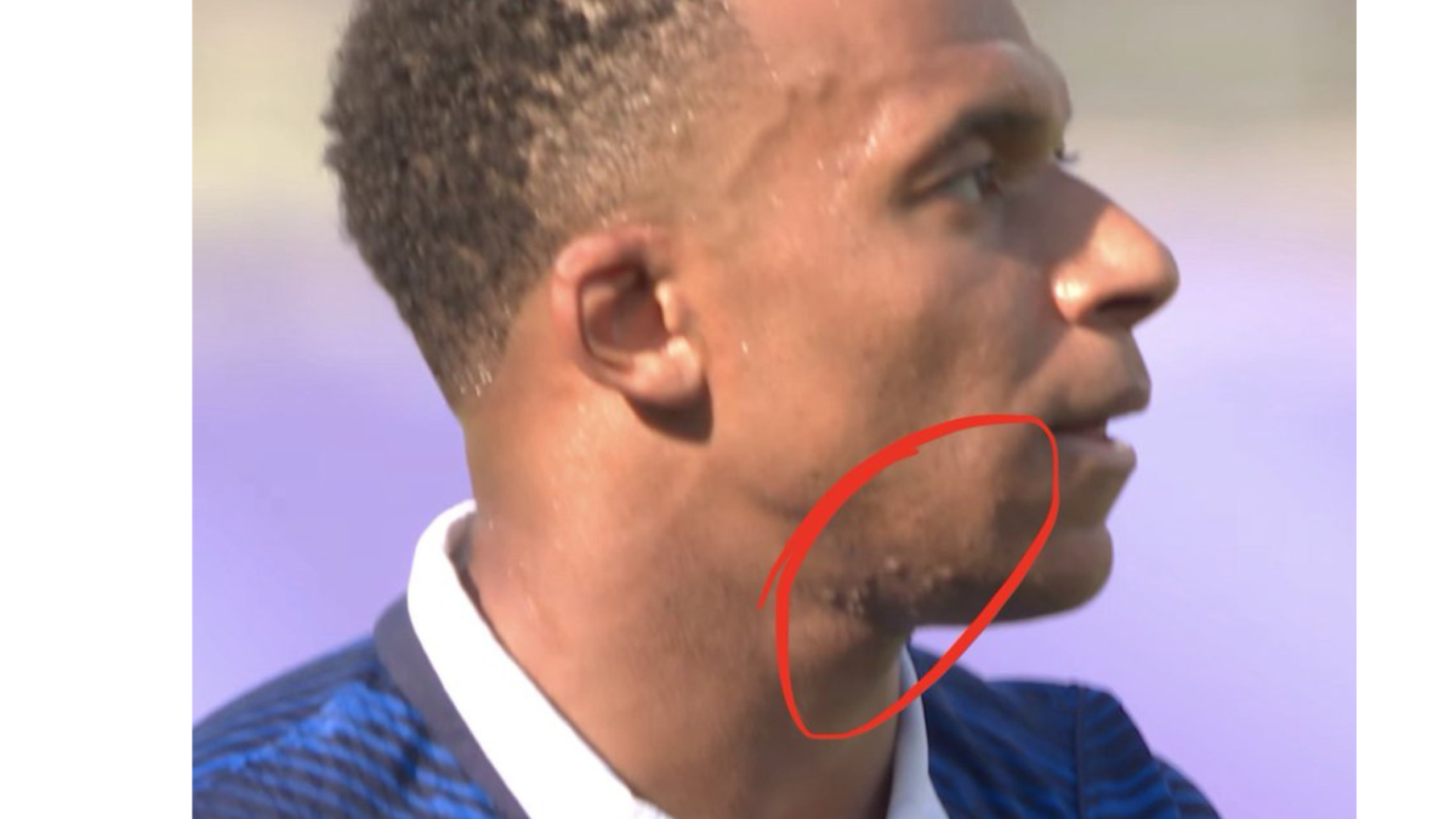 Mbappé