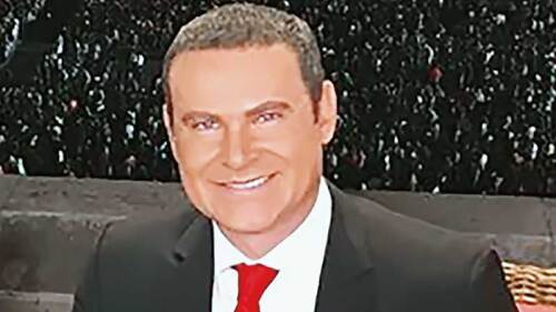 Alan Tacher se hizo microblanding.