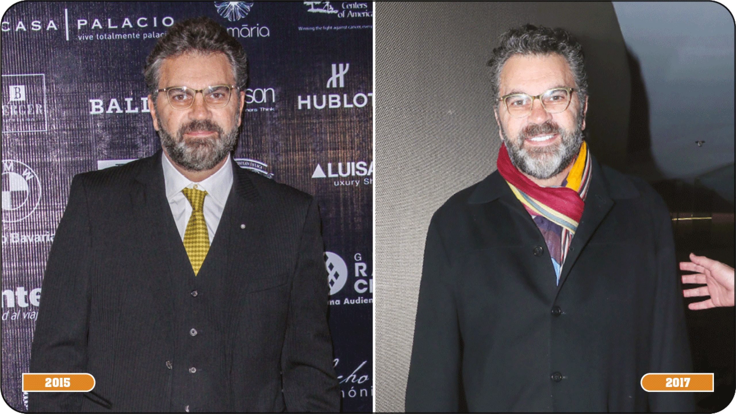 Manuel Mijares pérdida de peso
