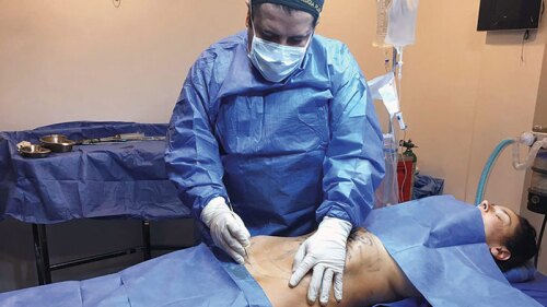 El Cirujano José Achar, revela el secreto de los famosos para lucir cuerpos espectaculares