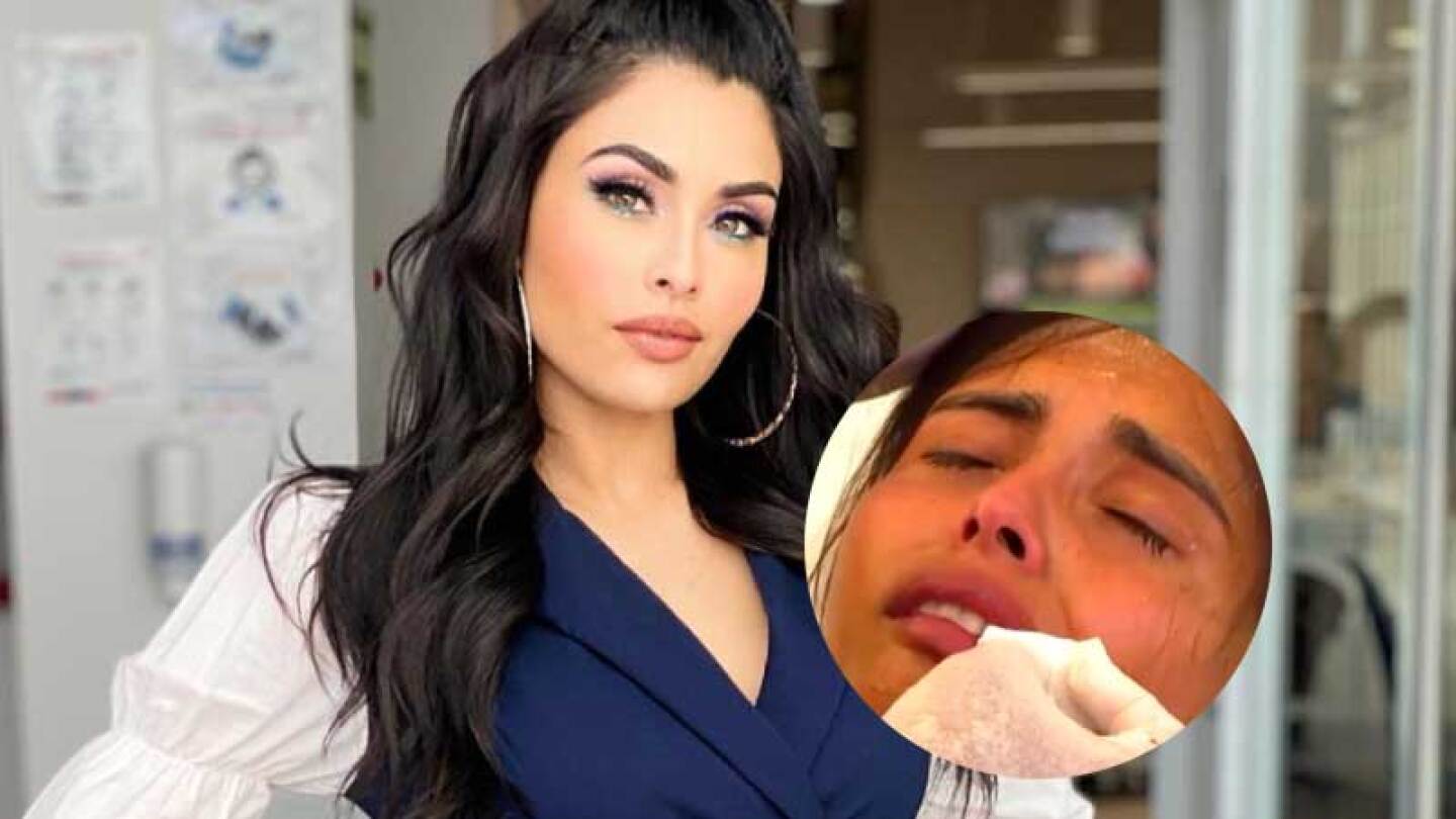 Kristal Silva sufre accidente en Survivor y llega la ambulancia de emergencia