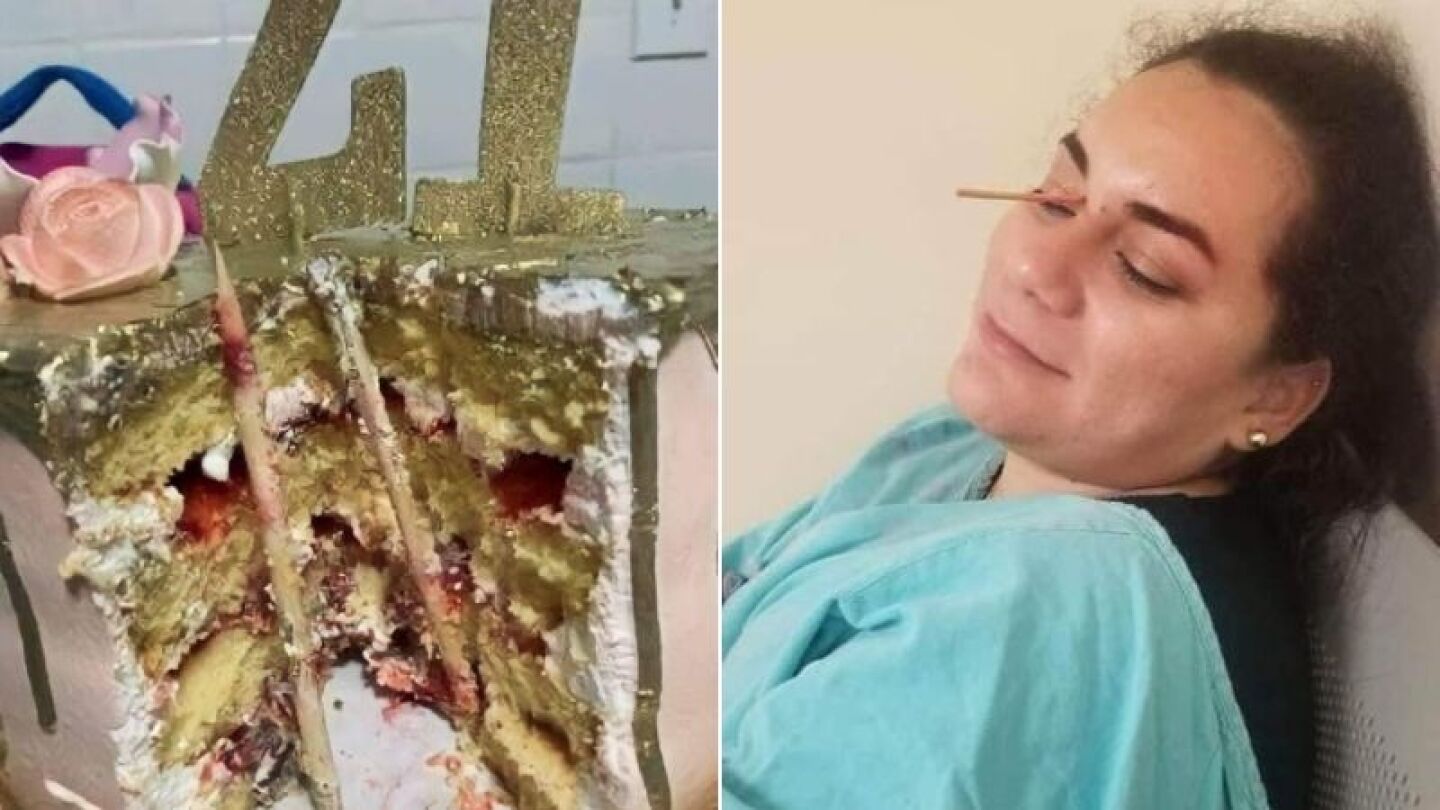 Mordida casi mortal: Avientan a mujer a su pastel de cumpleaños y casi pierde el ojo