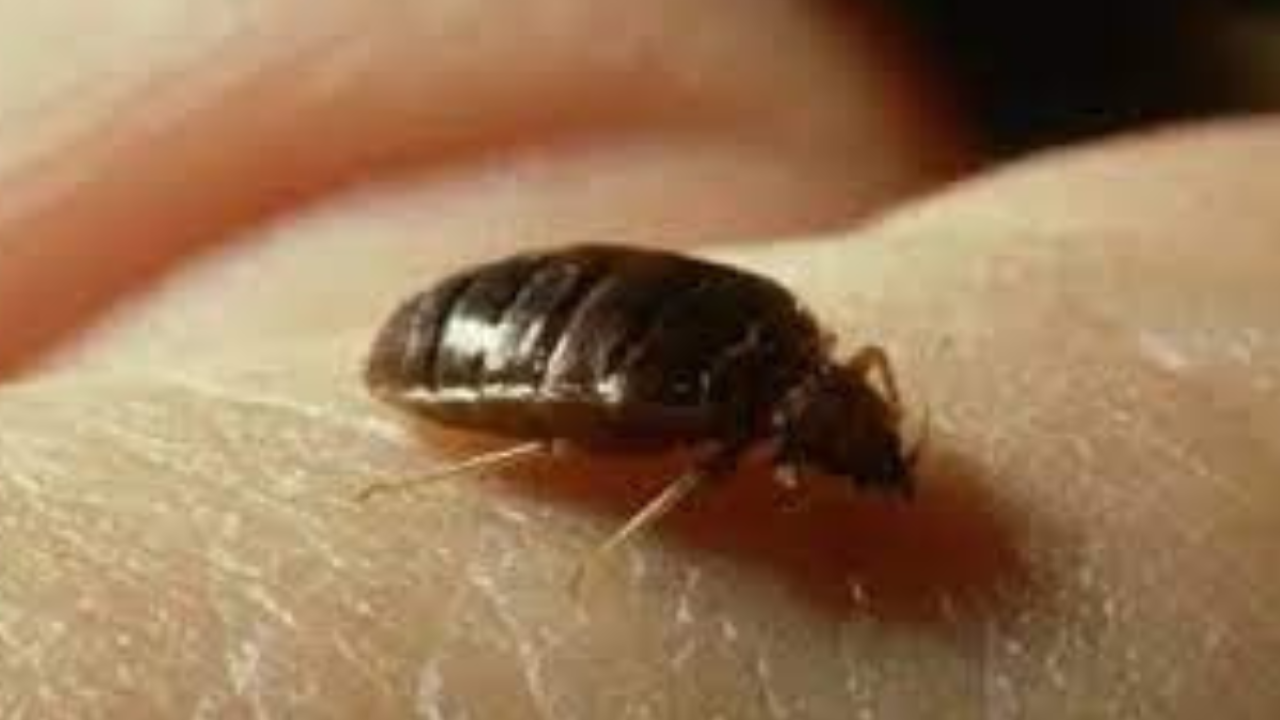 Plaga de chinches en Imagen Televisión alarma a conductores y personal: ¿qué programas están en riesgo?