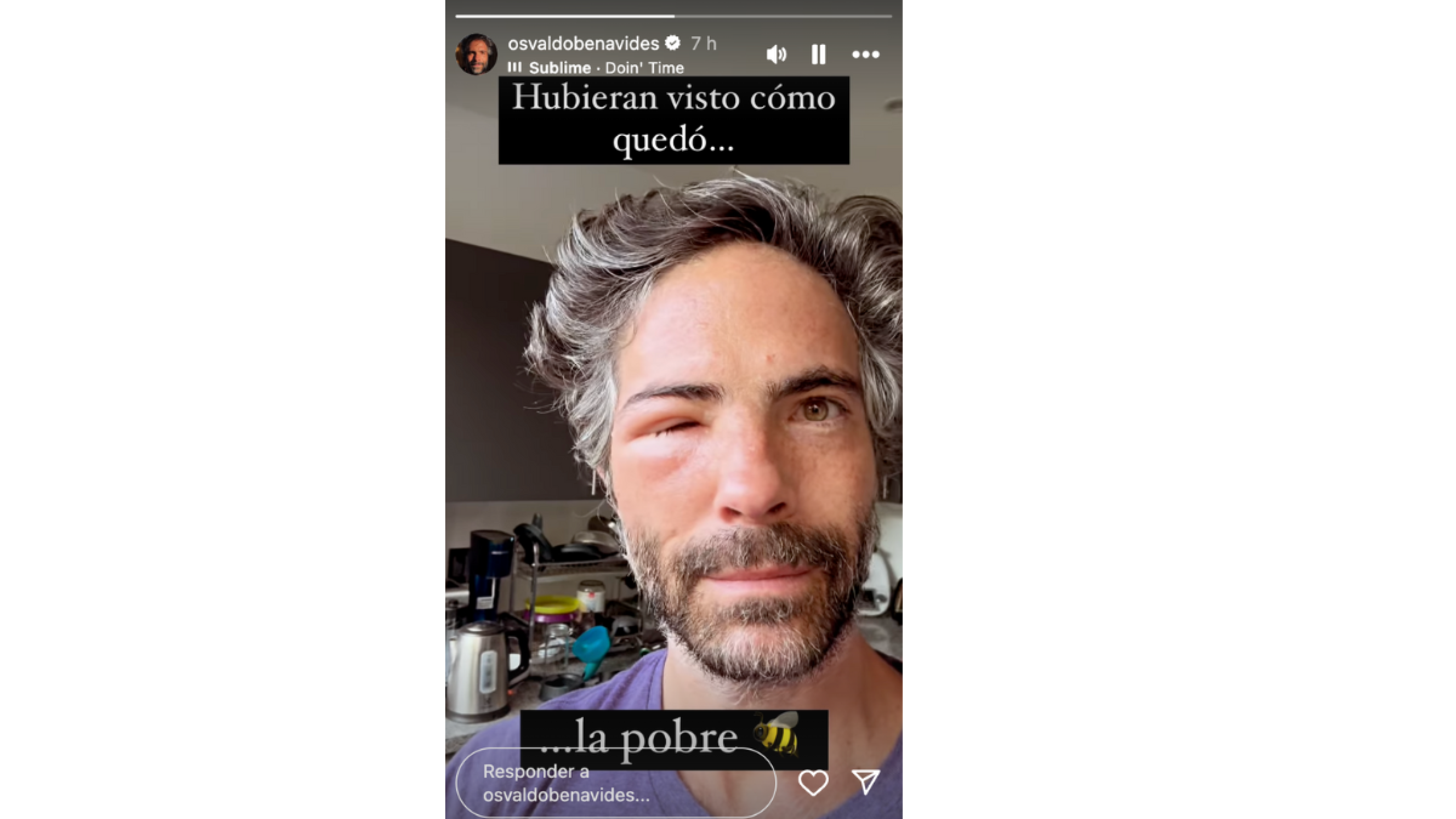 Osvaldo Benavides sufre picadura de una abeja