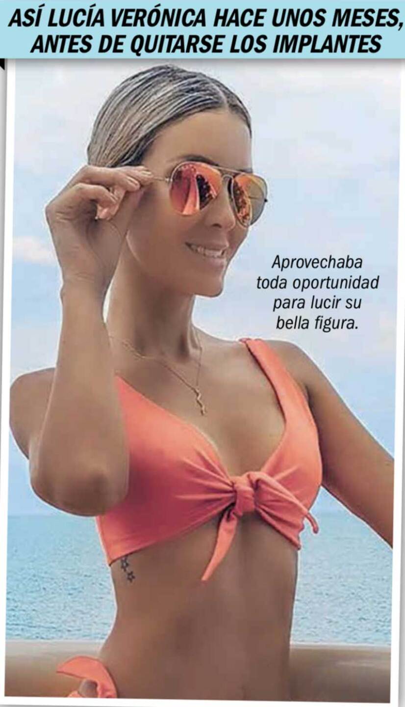 Verónica Montes se quitó los implantes de pecho