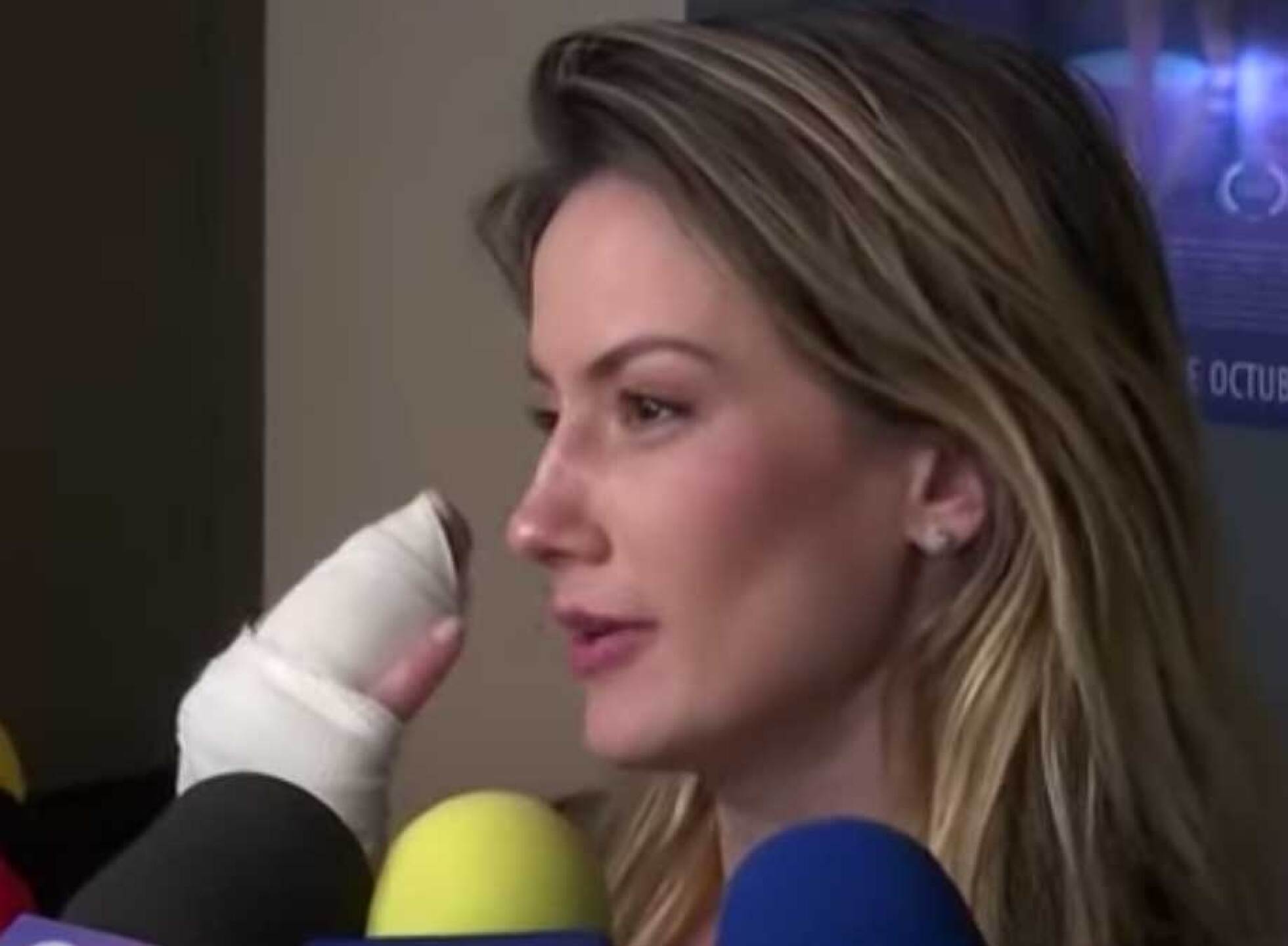 Altair Jarabo tuvo una cirugía en la mano tras accidente en su casa