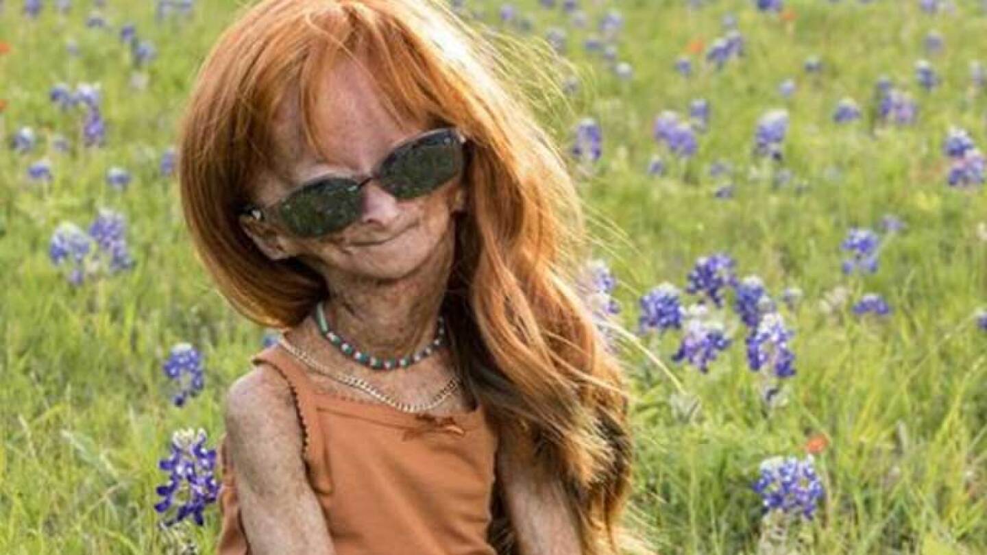 Muere Adalia Rose Williams, la youtuber que inspiró la película de Benjamin Button