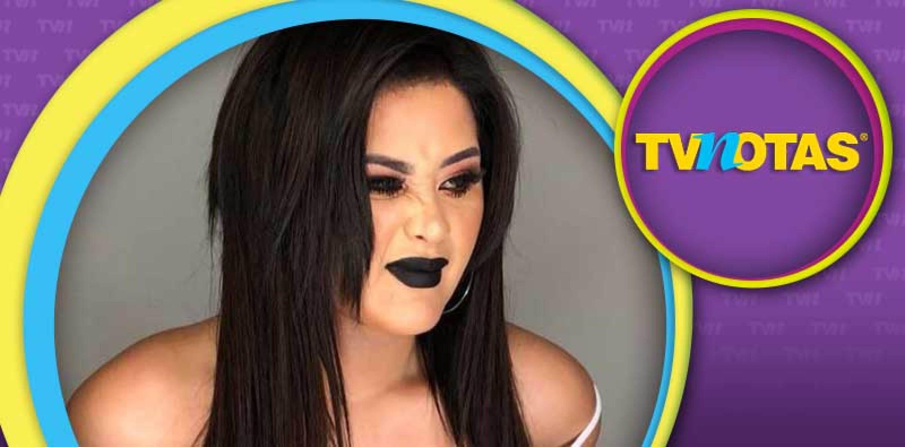 La expayasita fue duramente criticada por hacer evidente su adicción a las cirugías plásticas