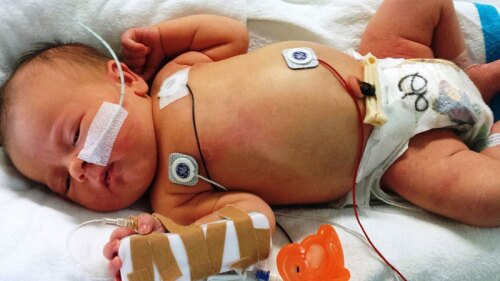 Deja morir a bebé con cáncer por tener dos mamás