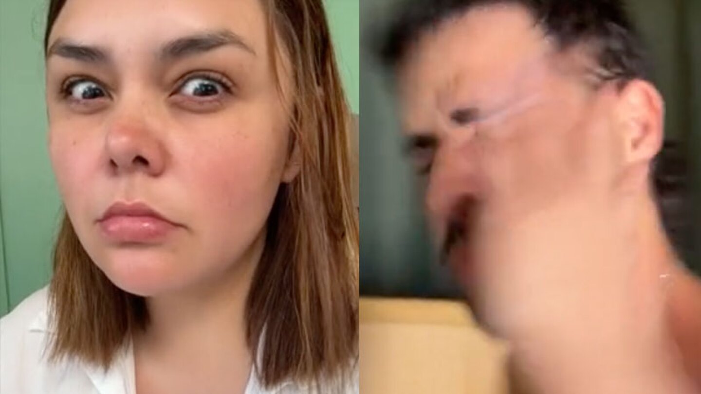 Matías cacheteado por Yuridia