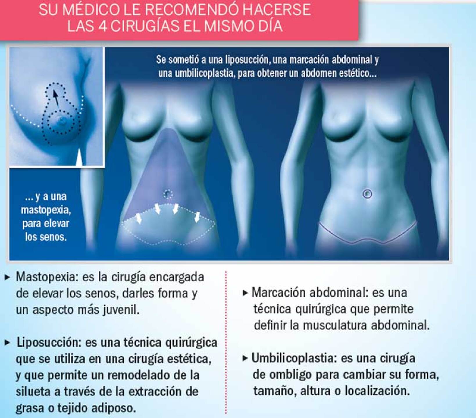 Jacqueline Bracamontes se sometió a varias cirugías