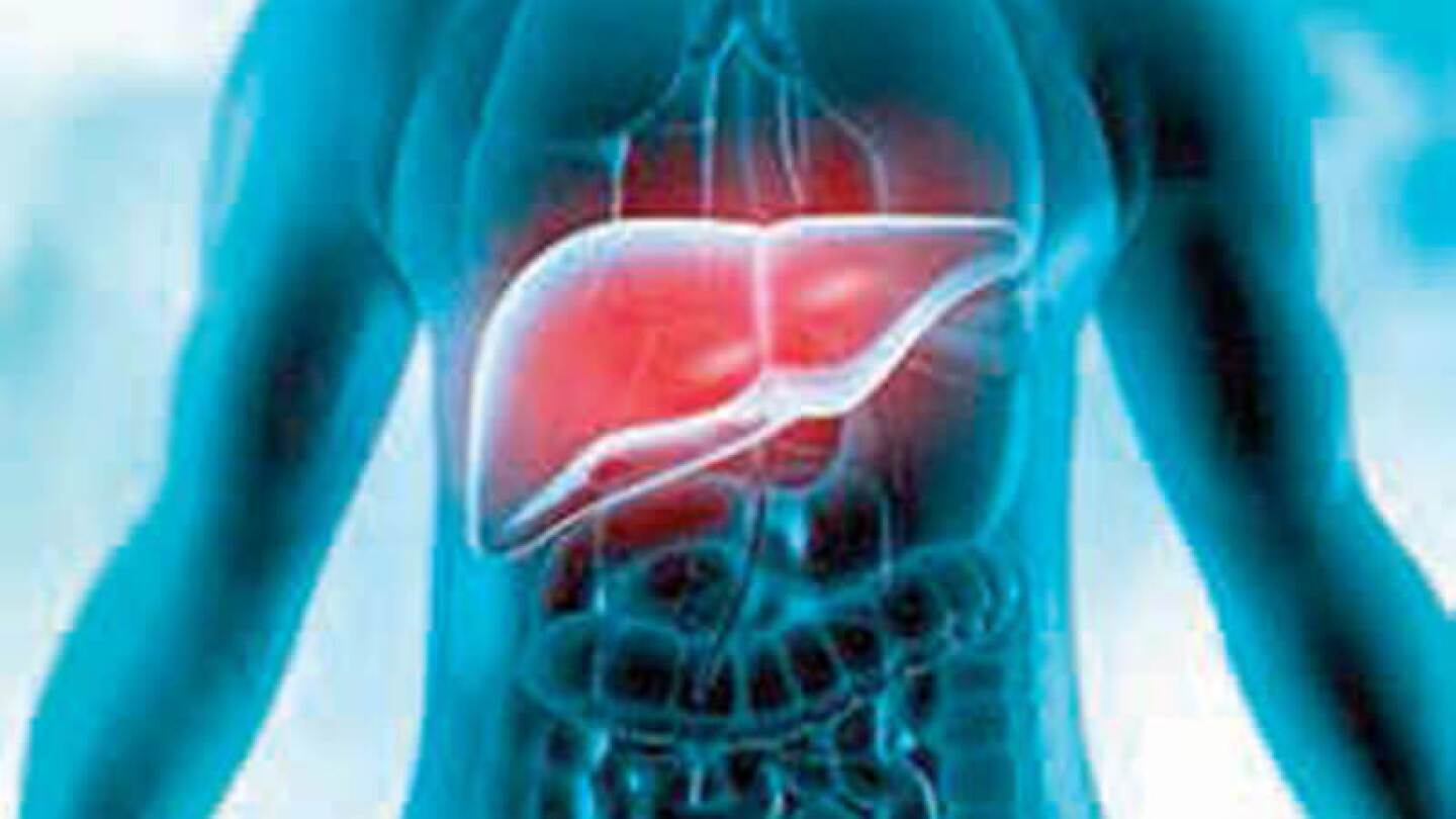 Disminuye las molestias por cirrosis hepática con las recomendaciones del Dr. Abel