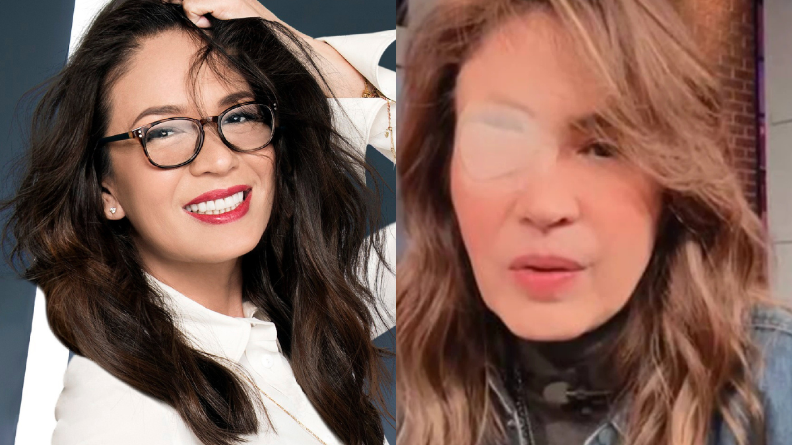 Yolanda Andrade reaparece irreconocible tras enfermedad degenerativa: así ha cambiado su físico con los años