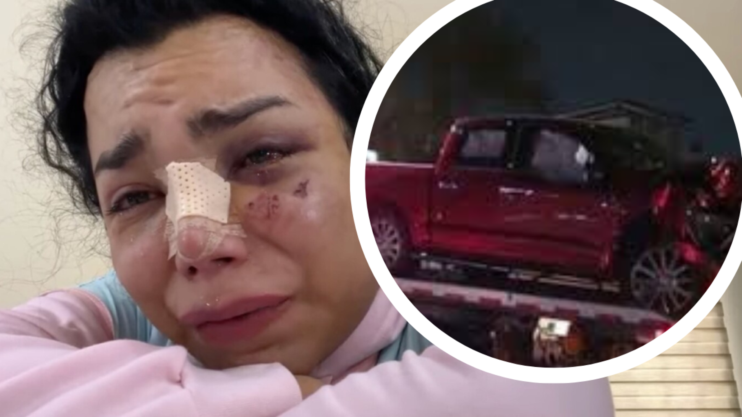 Paola Suárez reaparece tras accidente automovilístico