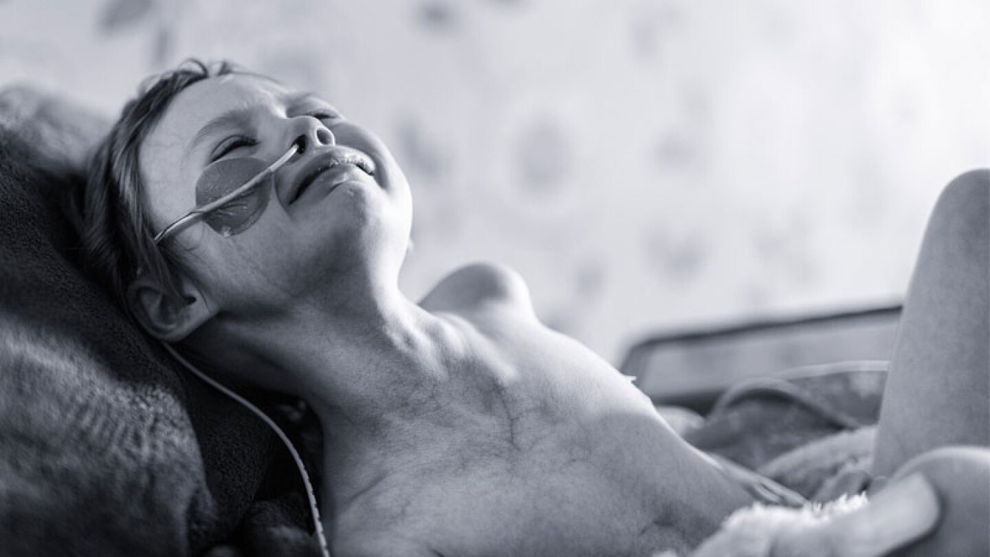 Niña de 4 años sufriendo en su batalla contra el cáncer.