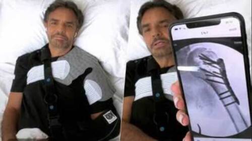 Eugenio Derbez asegura que fue operado por el mejor doctor