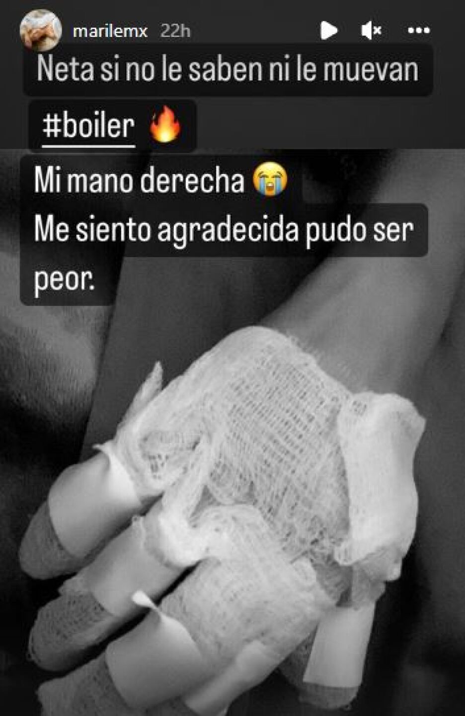 Marilé es víctima de una explosión de boiler en su casa