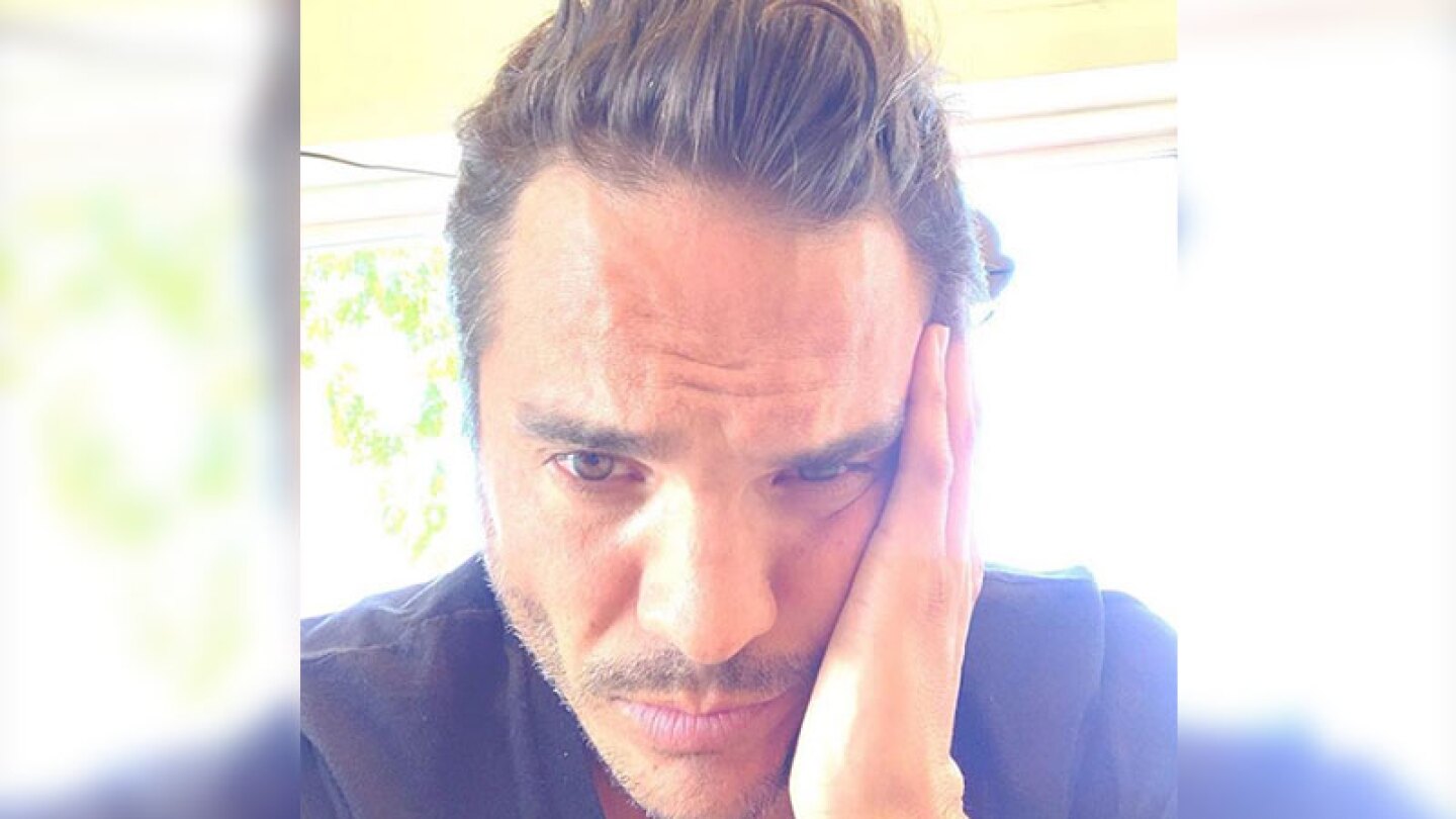 Kuno Becker recurrió al botox.