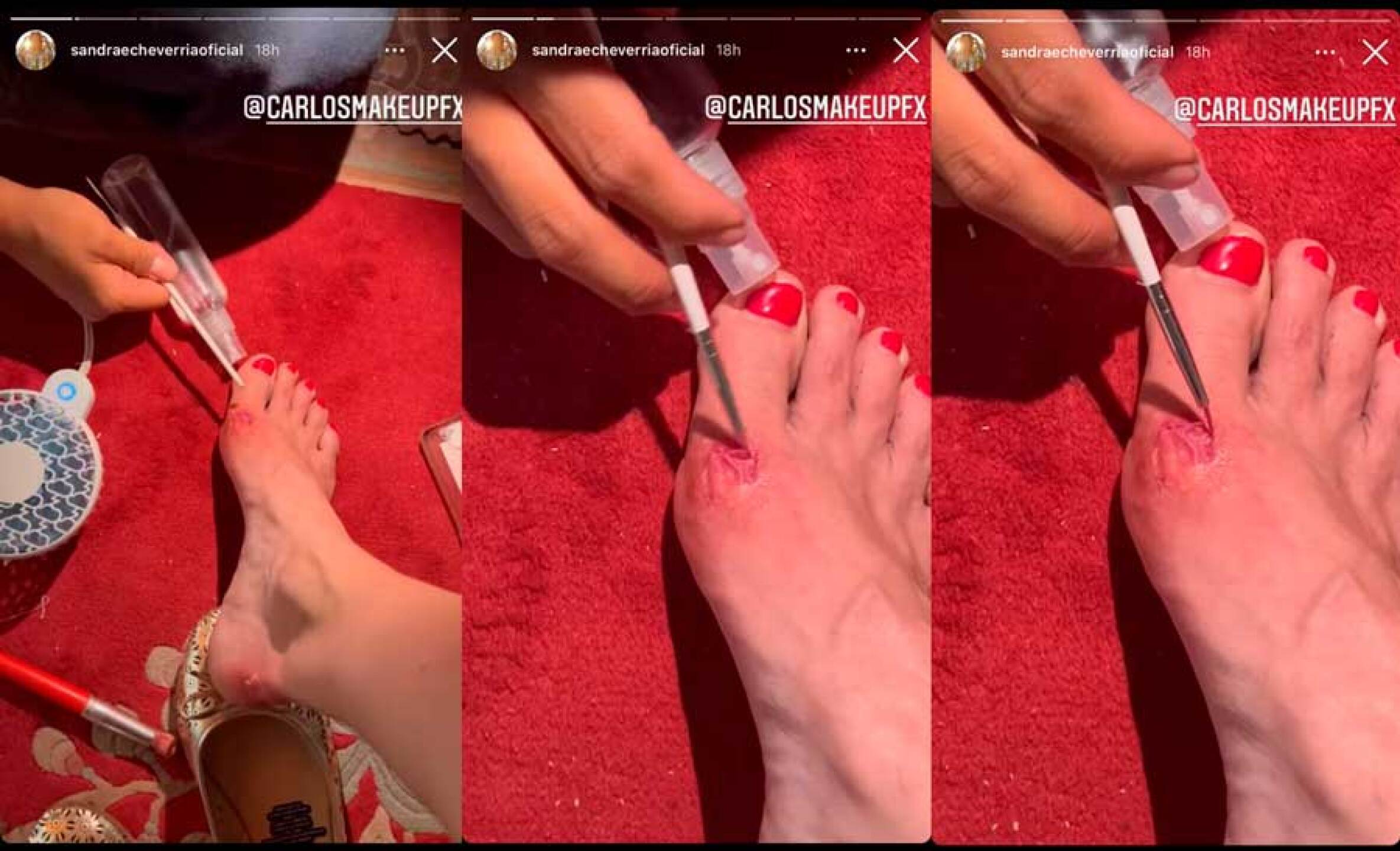 Sandra Echeverría sufre terrible llaga en su pie y comparte el terrible momento