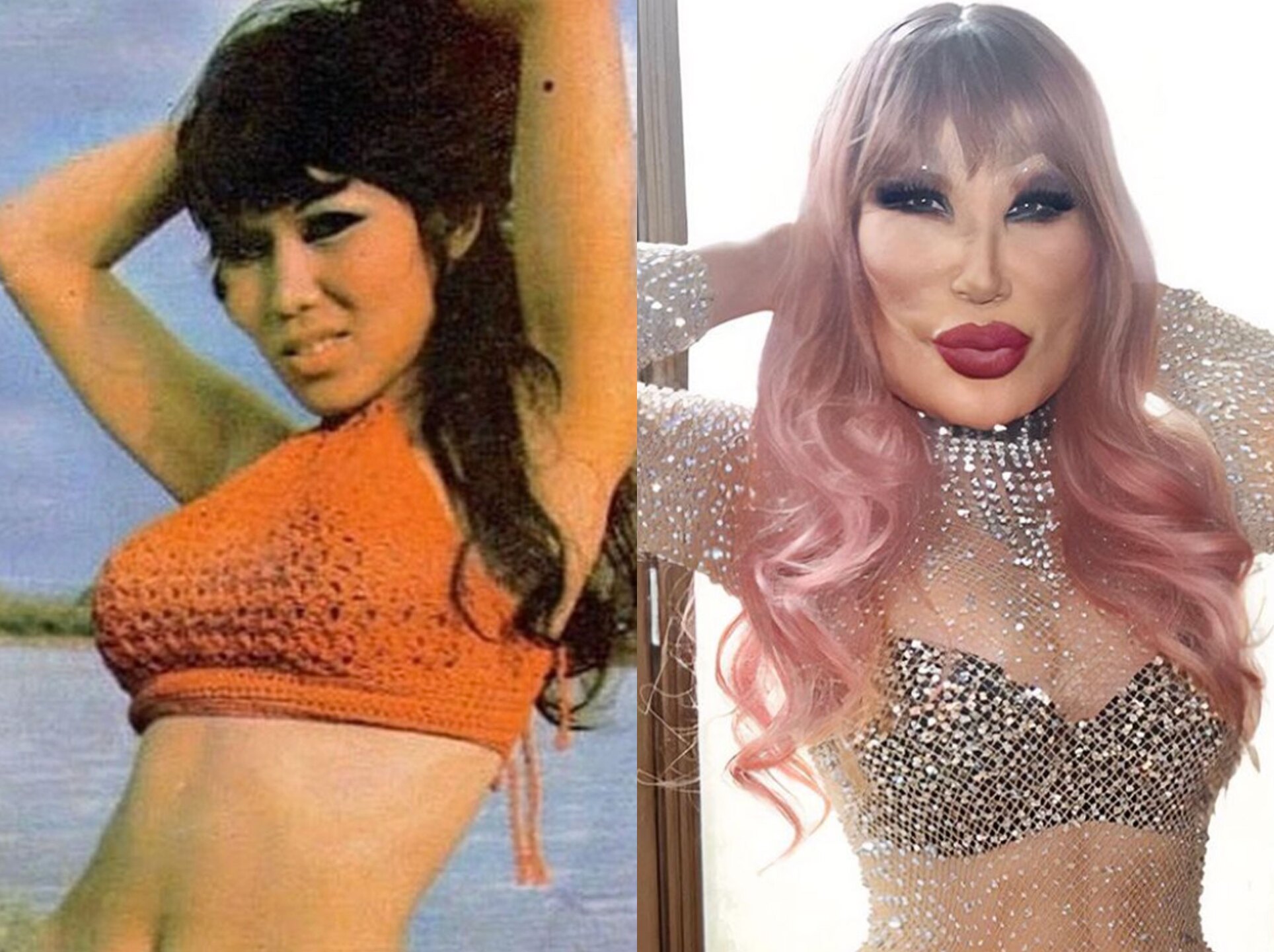 Lyn May antes y después