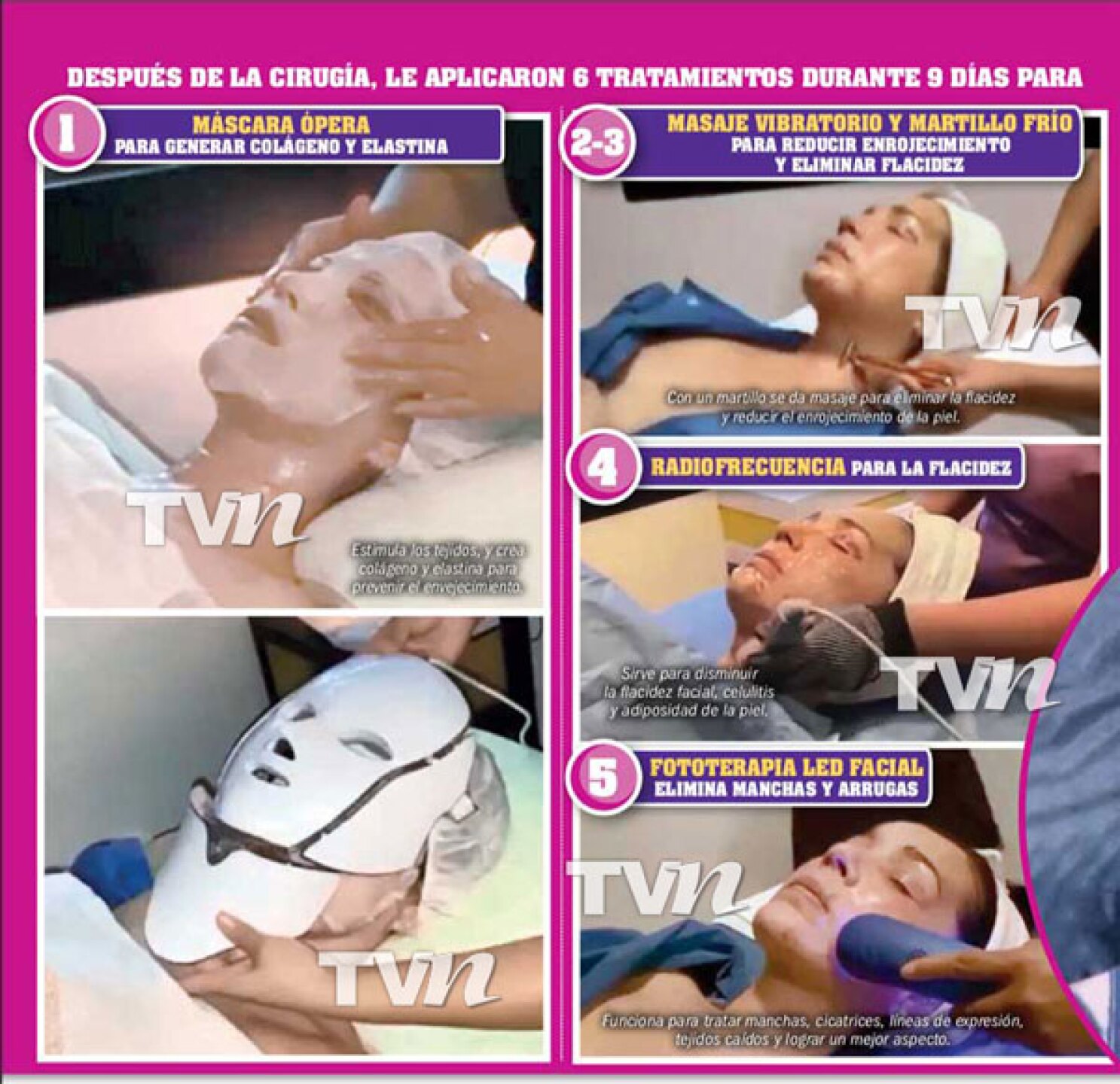 yolanda andrade cirugía rejuveneció