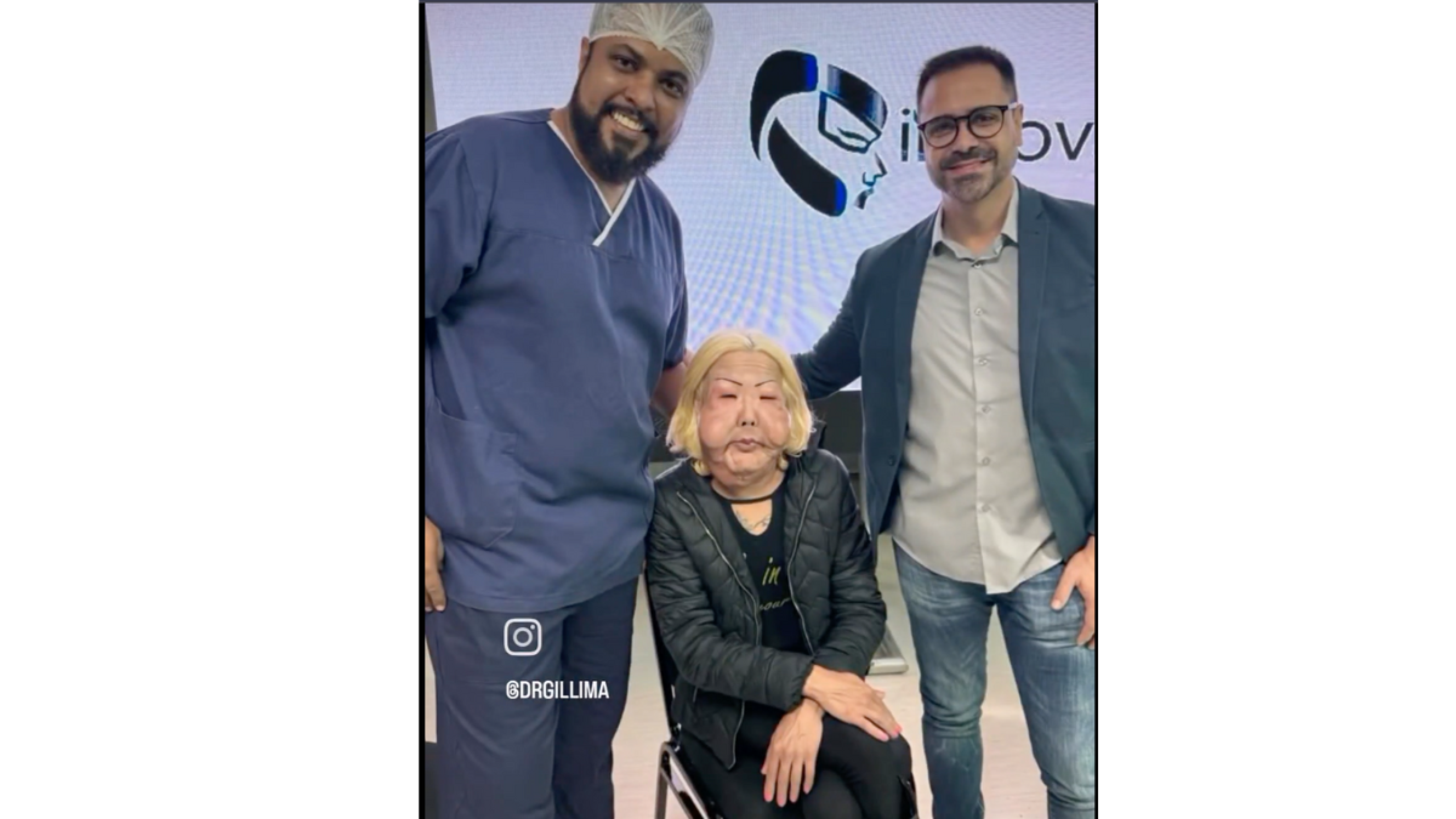 Aparece mujer con el rostro hinchado y redes entran en pánico