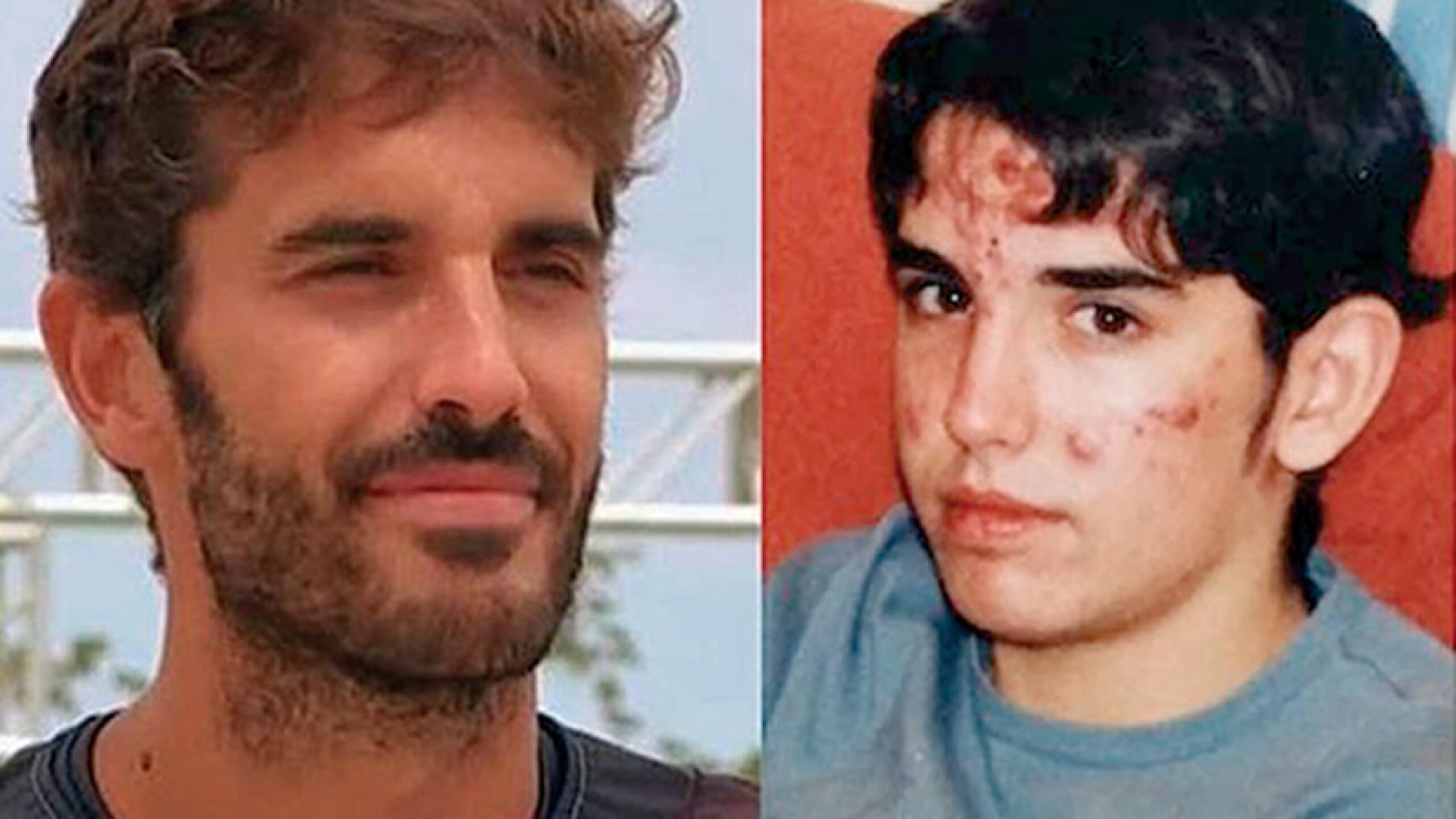 El acné afectó su adolescencia