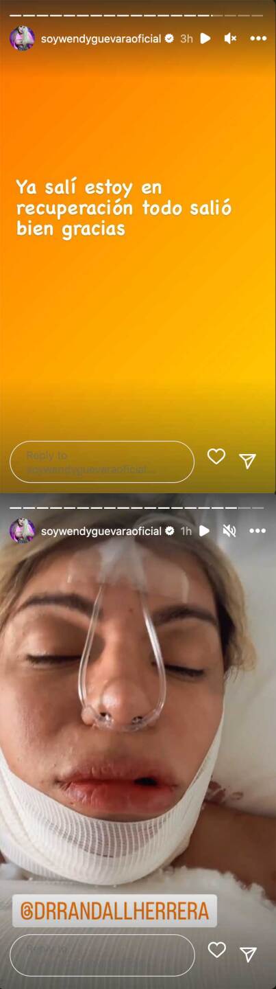 Wendy Guevara se sinceró sobre las intervenciones estéticas que se hizo