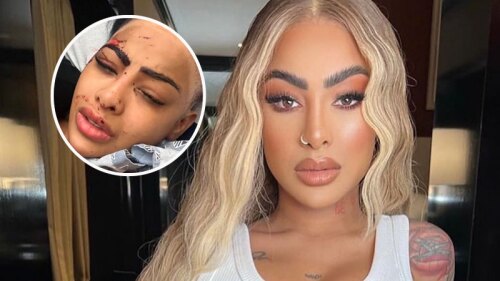 Yailin la más viral aparece golpeada