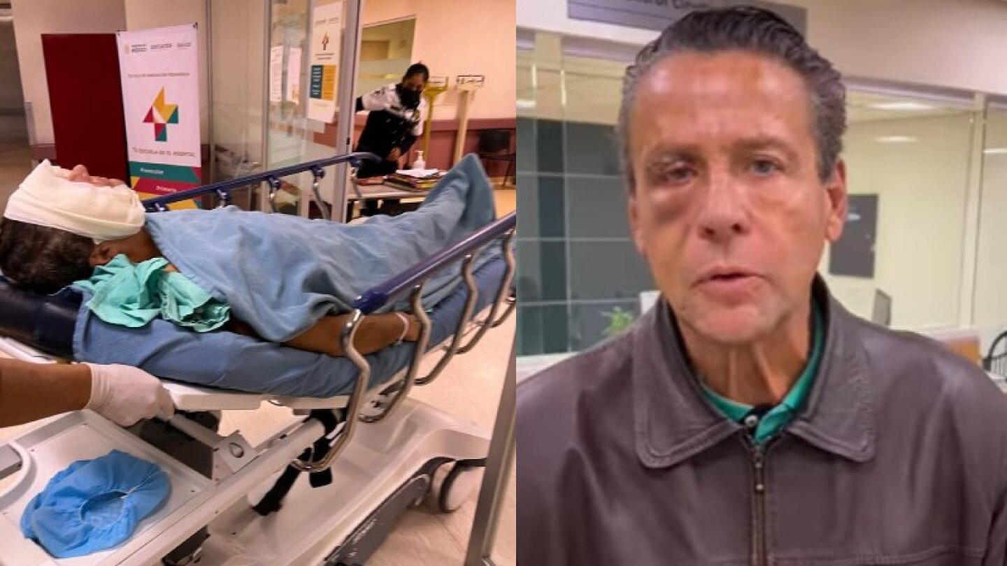 Alfredo Adame muestra los resultados de su cirugía en el ojo