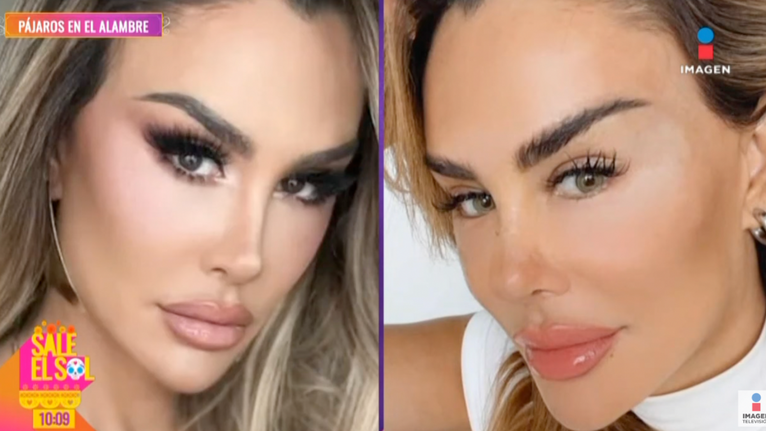 Ninel Conde se somete a cirugía para cambiar el color de sus ojos
