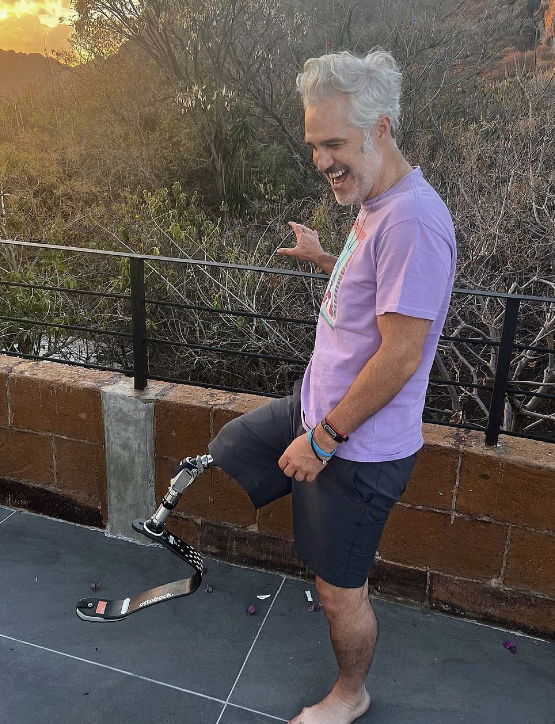 Juan Pablo Medina con su prótesis