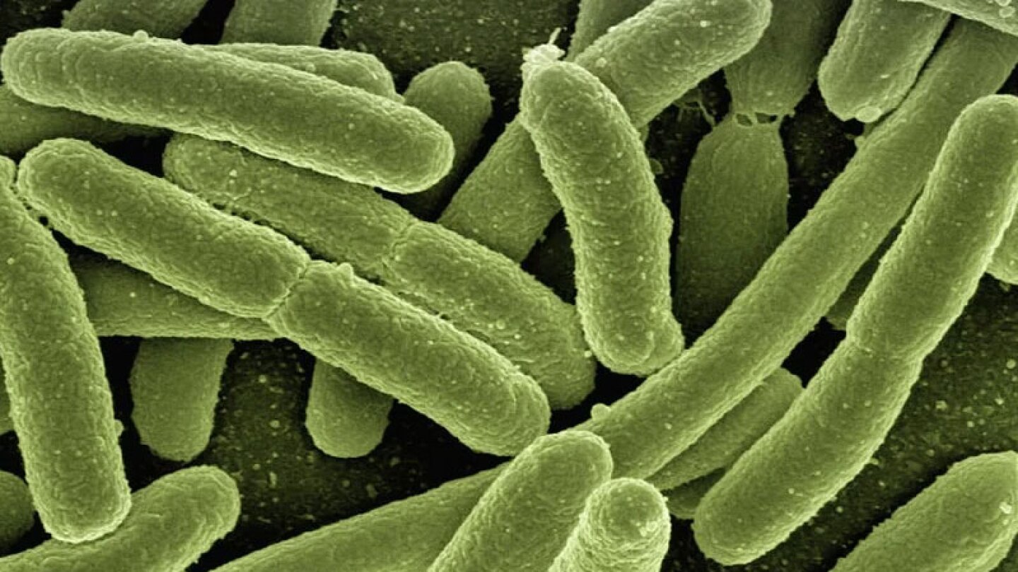 Reportan tres posible casos de coronavirus en Jalisco